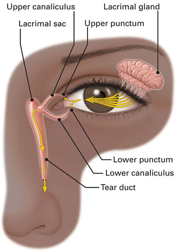 blocked tear duct infection